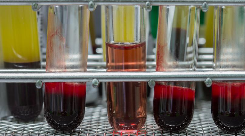 Closeup test tubes with blood for medical and biological analyzes, medicine equipment and health concept